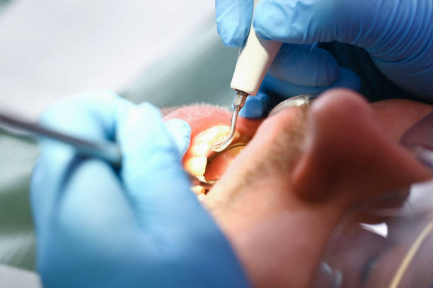 Best Emergency Dental Services for Seniors in Clover Creek, WA
